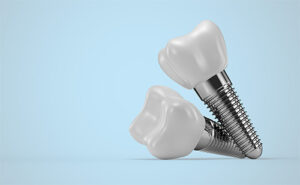 Dental Implant Device